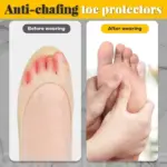 Silicone anti-friction toe protector - Image 6